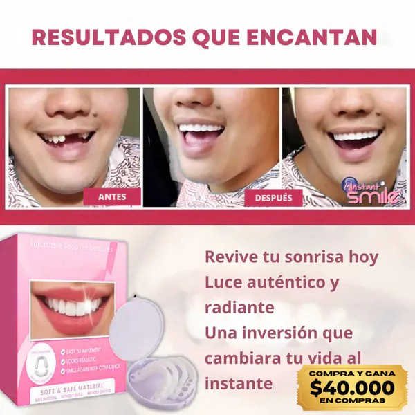 CARILLAS DENTALES SNAP-ON SMILE ✨ ¡Transforma tu sonrisa al instante y ahorra millones en tratamientos! Haz que tu sonrisa hable por ti 😁