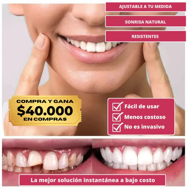 CARILLAS DENTALES SNAP-ON SMILE ✨ ¡Transforma tu sonrisa al instante y ahorra millones en tratamientos! Haz que tu sonrisa hable por ti 😁